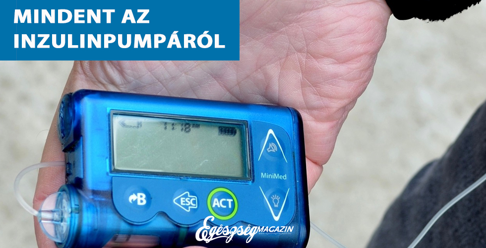 What Is Insulin Pump Therapy? - Medtronic Diabetes Magyarország