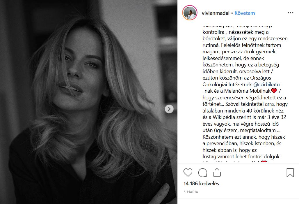 Mádai Vivien az Instagramon beszélt a melanómáról